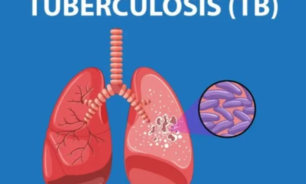 Multi-Drug Resistant Tuberculosis: Understand the Causes, Risk Factors, and Preventive Measures
